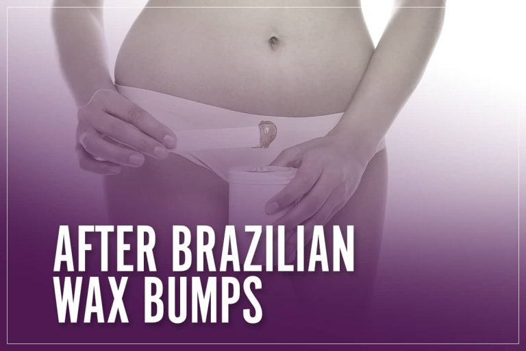 After Brazilian Wax Bumps: Prevention Tips & Irritation Remedies