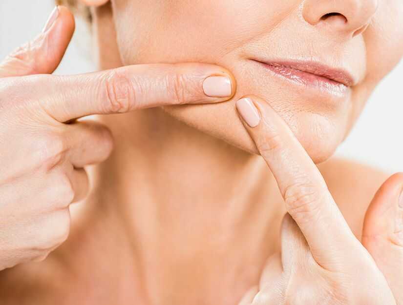 Extract Blackheads After Steaming