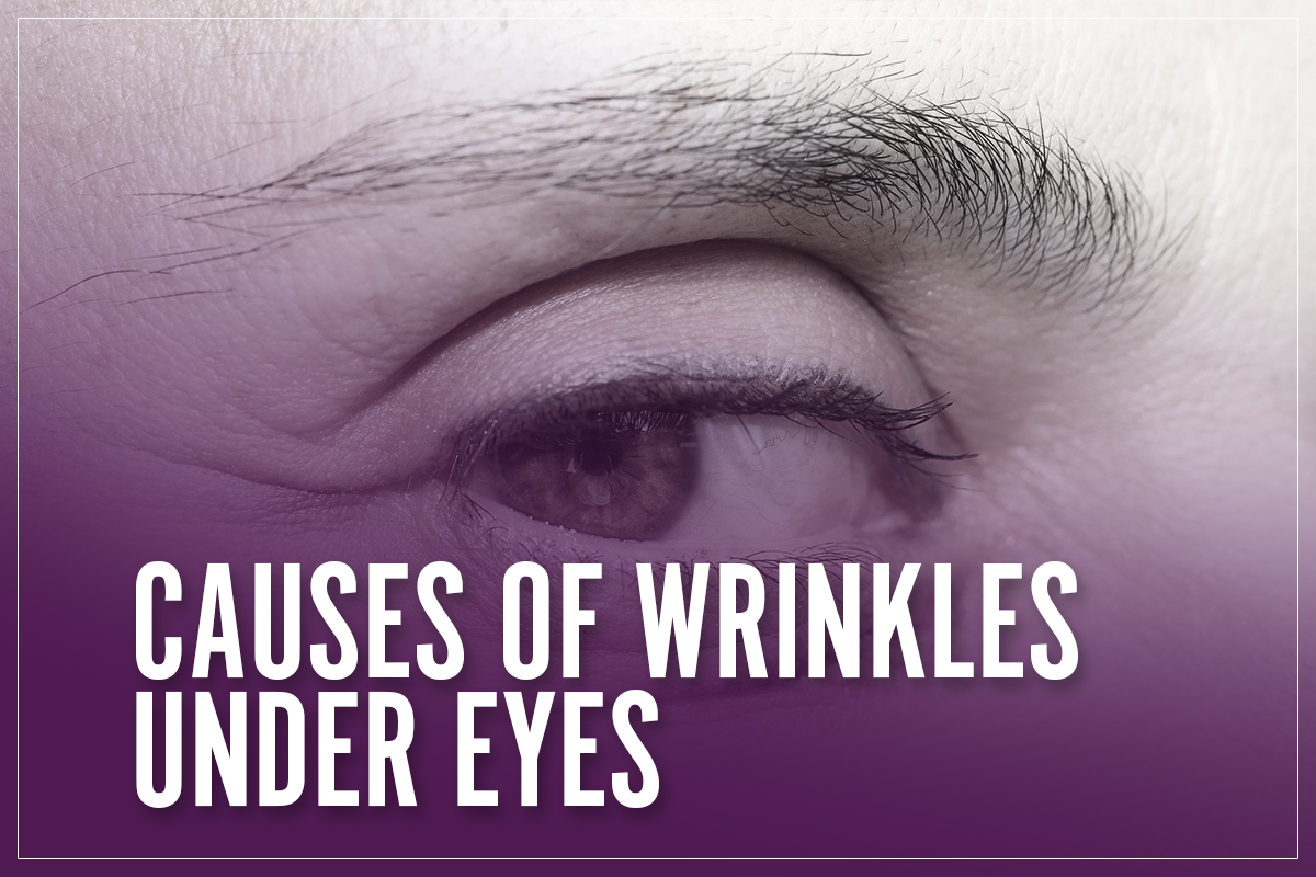 Causes Of Wrinkles Under Eyes