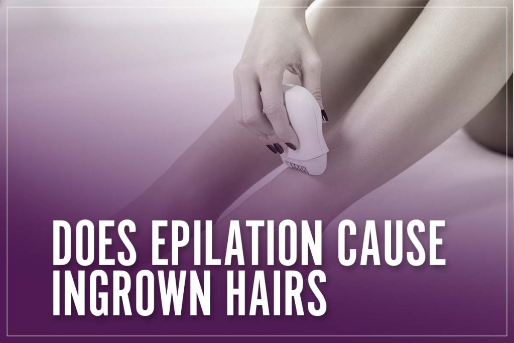 Does Epilation Cause Ingrown Hairs & How To Prevent It I Our 2023 Guide
