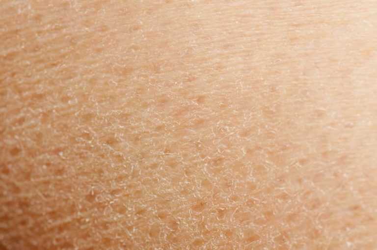 How To Improve Skin Elasticity And Keep It Firm [Quick Tips]