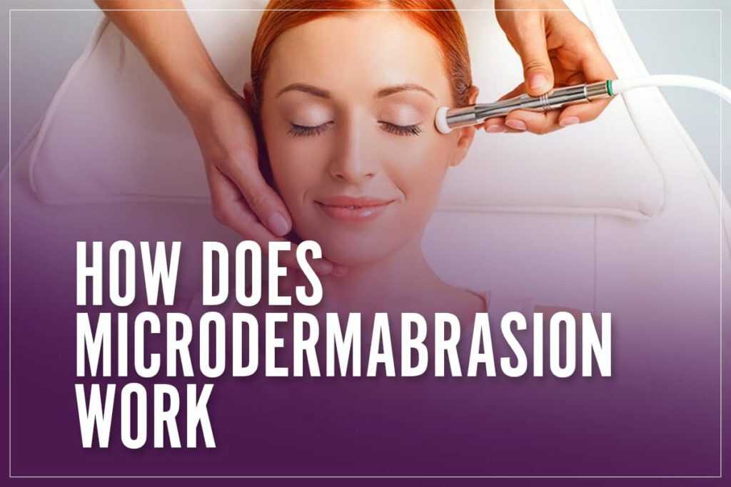 How Does Microdermabrasion Work? What Does It Do For Your Skin?