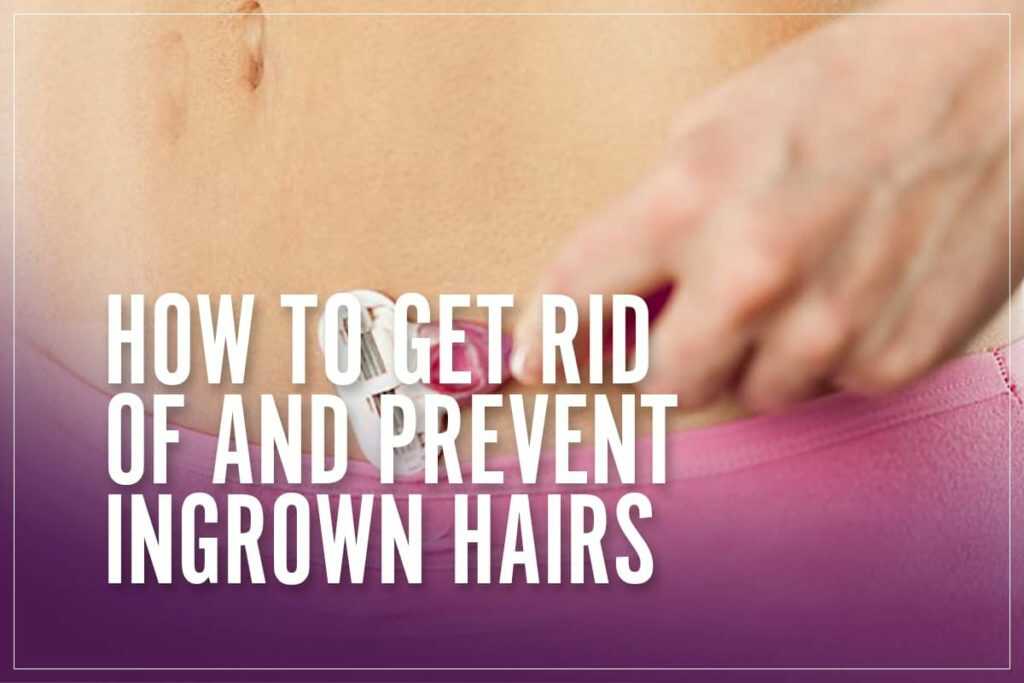 How To Get Rid Of & Prevent Ingrown Hairs [Treatment Guide]