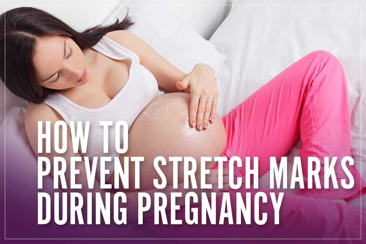 Prevent Stretch Marks In Pregnancy