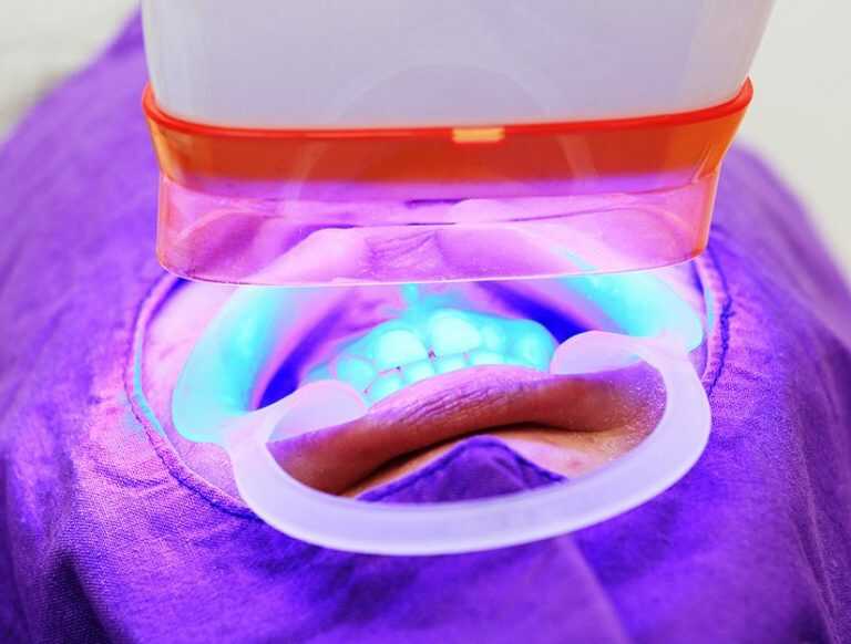 How Does UV (Ultraviolet) Light Help Whiten Your Teeth? [Does It Work?]